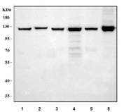 Western blot testing of 1) human HepG2, 2) human HeLa, 3) human SiHa, 4) rat liver, 5) rat RH35 and 6) mouse liver tissue lysate with Pyruvate Carboxylase antibody. Predicted molecular weight ~130 kDa.