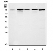 Western blot testing of 1) rat thymus, 2) mouse thymus, 3) mouse spleen, 4) mouse lung and 5) mouse RAW264.7 cell lysate with Interferon gamma receptor 1 antibody. Predicted molecular weight: ~54 kDa (unmodified), 80-100 kDa (glycosylated).