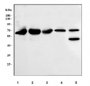 Western blot testing of 1) human placenta, 2) human HCCT, 3) human HCCP, 4) rat brain and 5) mouse brain tissue lysate with B-cell lymphoma 3 antibody. Predicted molecular weight ~60 kDa.