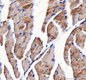 IHC staining of FFPE mouse heart tissue with ATP5F1D antibody. HIER: boil tissue sections in pH8 EDTA for 20 min and allow to cool before testing.