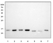 Western blot testing of 1) human A549, 2) human HepG2, 3) human MCF7, 4) human Raji, 5) rat liver, 6) rat kidney, 7) mouse liver tissue lysate with ATP5F1D antibody. Predicted molecular weight ~17 kDa.