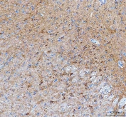 IHC staining of FFPE rat brain tissue with IDUA antibody. HIER: boil tissue sections in pH8 EDTA for 20 min and allow to cool before testing.