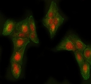 Immunofluorescent staining of FFPE human U-2 OS cells with 4-Alpha-glucanotransferase antibody (red) and Beta Tubulin mAb (green). HIER: steam section in pH6 citrate buffer for 20 min.