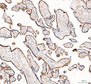 IHC staining of FFPE human placental tissue with 4-Alpha-glucanotransferase antibody. HIER: boil tissue sections in pH8 EDTA for 20 min and allow to cool before testing.