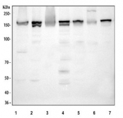Western blot testing of 1) human Jurkat, 2) human RT4, 3) human K562, 4) rat heart, 5) rat liver, 6) mouse heart and 7) mouse liver tissue lysate with 4-Alpha-glucanotransferase antibody. Predicted molecular weight ~174 kDa.