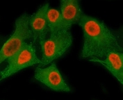 Immunofluorescent staining of FFPE human A549 cells with Matrin 3 antibody (red) and Beta Tubulin mAb (green). HIER: steam section in pH6 citrate buffer for 20 min.