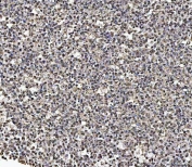 IHC staining of FFPE human tonsil tissue with Matrin 3 antibody. HIER: boil tissue sections in pH8 EDTA for 20 min and allow to cool before testing.