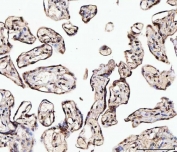 IHC staining of FFPE human placental tissue with Matrin 3 antibody. HIER: boil tissue sections in pH8 EDTA for 20 min and allow to cool before testing.
