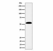 Western blot testing of human SW480 cell lysate with Aldehyde dehydrogenase 7A1 antibody. Predicted molecular weight ~58 kDa.
