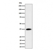 Western blot testing of human Jurkat cell lysate with RASSF2 antibody. Predicted molecular weight ~38 kDa.