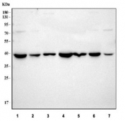 Western blot testing of 1) rat heart, 2) rat kidney, 3) rat brain, 4) mouse heart, 5) mouse kidney, 6) mouse brain and 7) rat HBZY cell lysate with IDH3G antibody. Predicted molecular weight ~41 kDa.