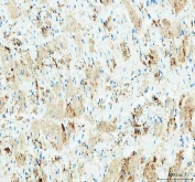 IHC staining of FFPE rat heart tissue with IDH3G antibody. HIER: boil tissue sections in pH8 EDTA for 20 min and allow to cool before testing.