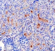 IHC staining of FFPE human mouse kidney tissue with Lumican antibody. HIER: boil tissue sections in pH8 EDTA for 20 min and allow to cool before testing.