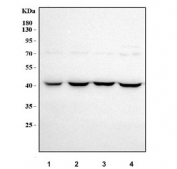 Western blot testing of human 1) HepG2, 2) MCF7, 3) K562 and 4) Caco-2 cell lysate with Diphosphomevalonate decarboxylase antibody. Predictec molecular weight ~43 kDa.