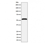 Western blot testing of human Jurkat cell lysate with Membrane Palmitoylated Protein 1 antibody. Expected molecular weight 52-55 kDa.