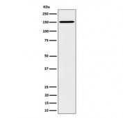Western blot testing of human HeLa cell lysate with Vigilin antibody. Predicted molecular weight ~141 kDa.