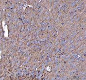 IHC staining of FFPE mouse brain tissue with Amyloid-like protein 2 antibody. HIER: boil tissue sections in pH8 EDTA for 20 min and allow to cool before testing.