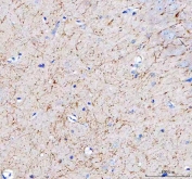 IHC staining of FFPE rat brain tissue with Amyloid-like protein 2 antibody. HIER: boil tissue sections in pH8 EDTA for 20 min and allow to cool before testing.