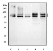 Western blot testing of 1) human SH-SY5Y, 2) human HepG2, 3) human HeLa, 4) rat brain and 5) mouse brain tissue lysate with Amyloid-like protein 2 antibody. Predicted molecular weight ~87 kDa, the glycosylated full length and truncated form can be observed at ~120 kDa and ~95 kDa, the CS-GAG modified form can be observed at 130-170 kDa and homodimers and heterodimers may be observed at over 200 kDa.