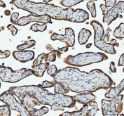 IHC staining of FFPE human placental tissue with RPL18 antibody. HIER: boil tissue sections in pH8 EDTA for 20 min and allow to cool before testing.