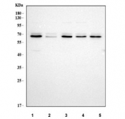 Western blot testing of human 1) HeLa, 2) 293T, 3) K562, 4) U-87 MG and 5) Jurkat cell lysate with MELK antibody. Predicted molecular weight: 53-75 kDa (multiple isoforms).