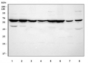 Western blot testing of 1) human Jurkat, 2) human 293T, 3) rat liver, 4) rat brain, 5) rat heart, 6) mouse liver, 7) mouse brain and 8) mouse heart tissue lysate with MTF1 antibody. Predicted molecular weight ~81 kDa, commonly observed at 65-81 kDa.
