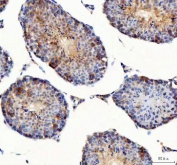 IHC staining of FFPE mouse testis tissue with PDK3 antibody. HIER: boil tissue sections in pH8 EDTA for 20 min and allow to cool before testing.