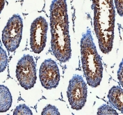 IHC staining of FFPE rat testis tissue with PDK3 antibody. HIER: boil tissue sections in pH8 EDTA for 20 min and allow to cool before testing.