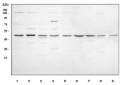 Western blot testing of 1) human MCF7, 2) human 293T, 3) human RT4, 4) human SiHa, 5) human Jurkat, 6) human U-251, 7) human A549, 8) rat testis and 9) mouse testis tissue lysate with PDK3 antibody. Predicted molecular weight ~47 kDa.