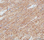 IHC staining of FFPE rat heart tissue with Mitofilin antibody. HIER: boil tissue sections in pH8 EDTA for 20 min and allow to cool before testing.