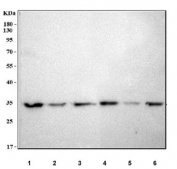 Western blot testing of 1) human HepG2, 2) human SH-SY5Y, 3) human MCF7, 4) rat C6, 5) mouse brain and 6) mouse Neuro-2a cell lysate with LRRC75B antibody. Predicted molecular weight ~35 kDa.