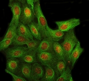 Immunofluorescent staining of FFPE human U-2 OS cells with LRIT3 antibody (red) and Beta Tubulin mAb (green). HIER: steam section in pH6 citrate buffer for 20 min.