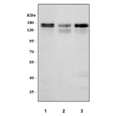 Western blot testing of human 1) HeLa, 2) RT4 and 3) HepG2 cell lysate with MAP1S antibody. Predicted molecular weight ~112 KDa, commonly observed at 112-150 kDa.