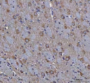 IHC staining of FFPE rat brain tissue with MAP1S antibody. HIER: boil tissue sections in pH8 EDTA for 20 min and allow to cool before testing.