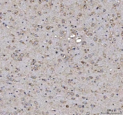 IHC staining of FFPE mouse brain tissue with MAP1S antibody. HIER: boil tissue sections in pH8 EDTA for 20 min and allow to cool before testing.