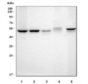 Western blot testing of 1) human 293T, 2) human HeLa, 3) human Jurkat, 4) rat thymus and 5) mouse thymus tissue lysate with LPCAT2 antibody. Predicted molecular weight ~60 kDa.