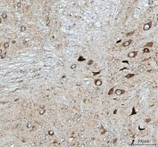 IHC staining of FFPE rat cerebellum tissue with Pellino-3 antibody. HIER: boil tissue sections in pH8 EDTA for 20 min and allow to cool before testing.