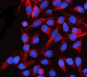 Immunofluorescent staining of FFPE human HeLa cells with SLC38A9 antibody (red) and DAPI nuclear stain (blue). HIER: steam section in pH6 citrate buffer for 20 min.