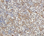 IHC staining of FFPE human testicular germ cell tumor tissue with MOSPD2 antibody. HIER: boil tissue sections in pH8 EDTA for 20 min and allow to cool before testing.