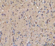 IHC staining of FFPE human brain tissue with MOSPD2 antibody. HIER: boil tissue sections in pH8 EDTA for 20 min and allow to cool before testing.