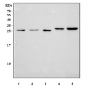 Western blot testing of 1) human A549, 2) human PC-3, 3) human MCF7, 4) rat liver and 5) mouse liver tissue lysate with Josephin 2 antibody. Predicted molecular weight ~21 kDa.