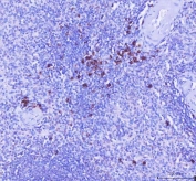 IHC staining of FFPE human spleen tissue with MZB1 antibody. HIER: boil tissue sections in pH8 EDTA for 20 min and allow to cool before testing.