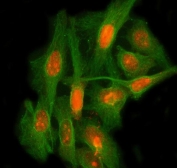 Immunofluorescent staining of FFPE human HeLa cells with LEO1 antibody (red) and Beta Tubulin mAb (green). HIER: steam section in pH6 citrate buffer for 20 min.