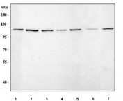 Western blot testing of 1) human HeLa, 2) human MCF7, 3) human HepG2, 4) human A549, 5) human RT4, 6) rat brain and 7) mouse C2C12 cell lysate with LEO1 antibody. Predicted molecular weight ~75 kDa but can be observed at ~105 kDa.