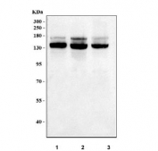 Western blot testing of human 1) 293T, 2) HeLa and 3) Caco-2 cell lysate with LMO7 antibody. Predicted molecular weight: 153-193 kDa (multiple isoforms).