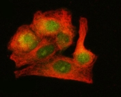 Immunofluorescent staining of FFPE human A549 cells with LZIC antibody (green) and Beta Tubulin mAb (red). HIER: steam section in pH6 citrate buffer for 20 min.