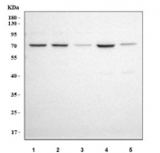 Western blot testing of 1) human K562, 2) human 293T, 3) human SH-SY5Y, 4) human HepG2 and 5) rat brain tissue lysate with IGSF8 antibody. Predicted molecular weight ~65 kDa.
