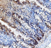 IHC staining of FFPE rat colon tissue with LRRC59 antibody. HIER: boil tissue sections in pH8 EDTA for 20 min and allow to cool before testing.