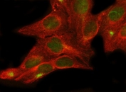 Immunofluorescent staining of FFPE human U-2 OS cells with GbetaL antibody (green) and Beta Tubulin mAb (red). HIER: steam section in pH6 citrate buffer for 20 min.