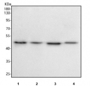 Western blot testing of human 1) HeLa, 2) Jurkat, 3) MCF7 and 4) 293T cell lysate with INO80B antibody. Predicted molecular weight ~39 kDa, commonly observed at 45-50 kDa.